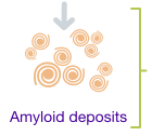 Amyloid deposits.
